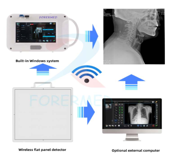 Game-Changing Portable Radiography